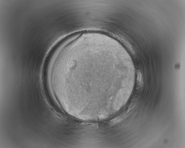 X0000116440676201001191532