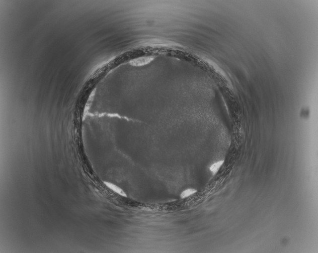 X0000116440775201001191531