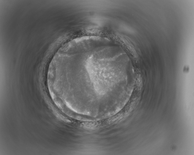 X0000116440817201001191530