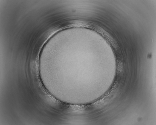 X0000116440836201001191530