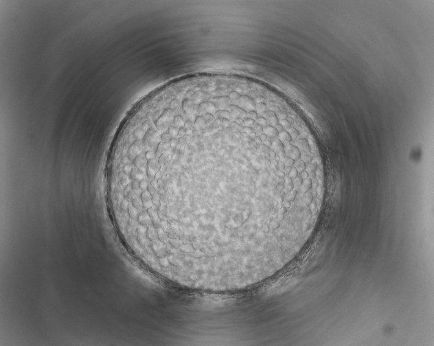 X0000116440848201001191530