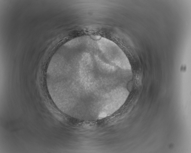 X0000116440865201001191530