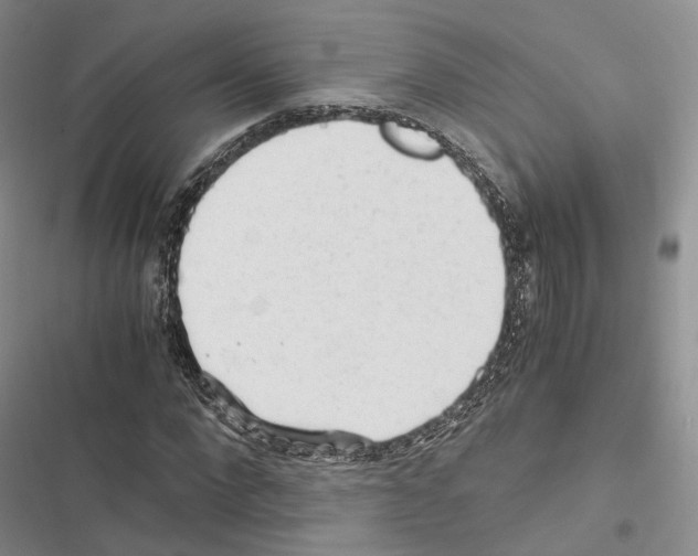 X0000116440872201001191530