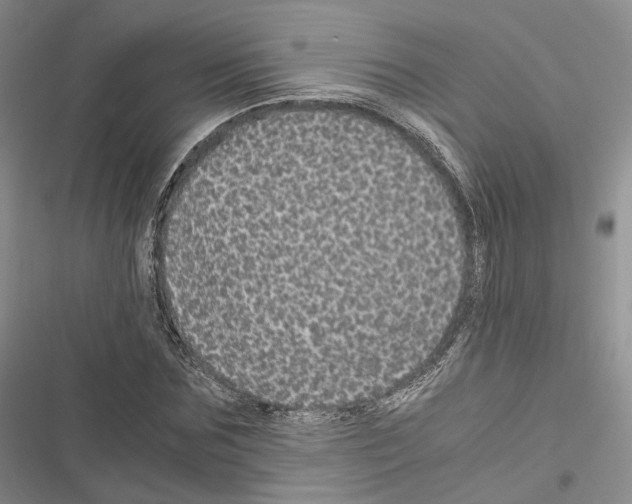 X0000116440875201001191529