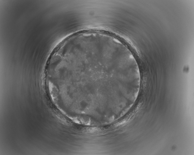 X0000116440879201001191529