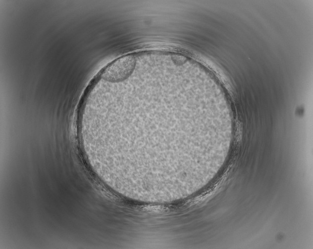 X0000116440883201001191529