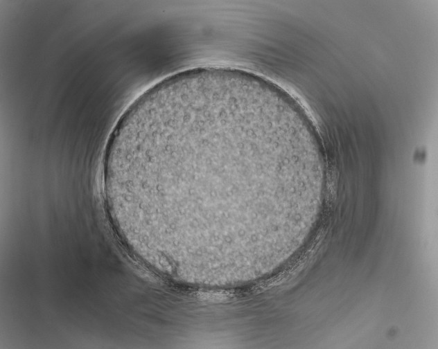 X0000116440887201001191529