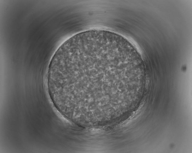 X0000116440903201001191529