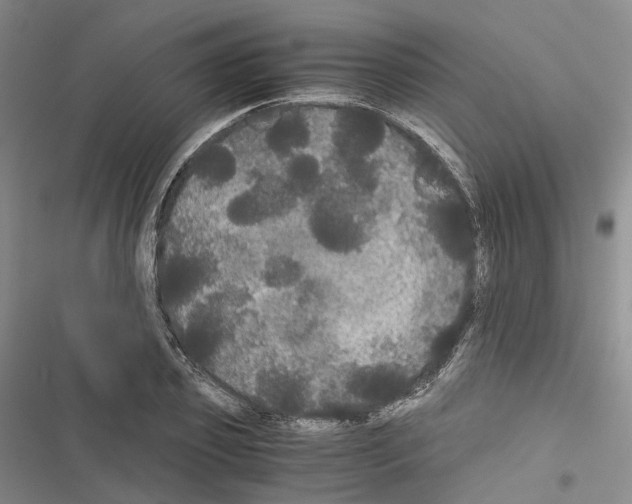 X0000116440933201001191529