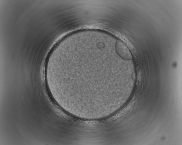 X0000116440934201001191529