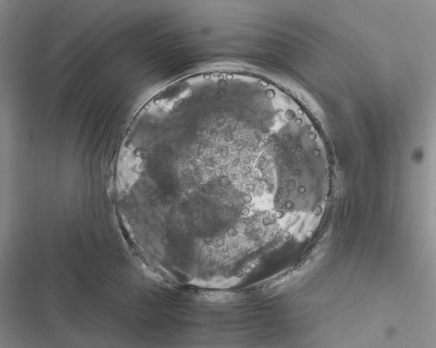 X0000116440953201001191529