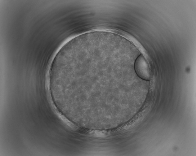 X0000116440955201001191529