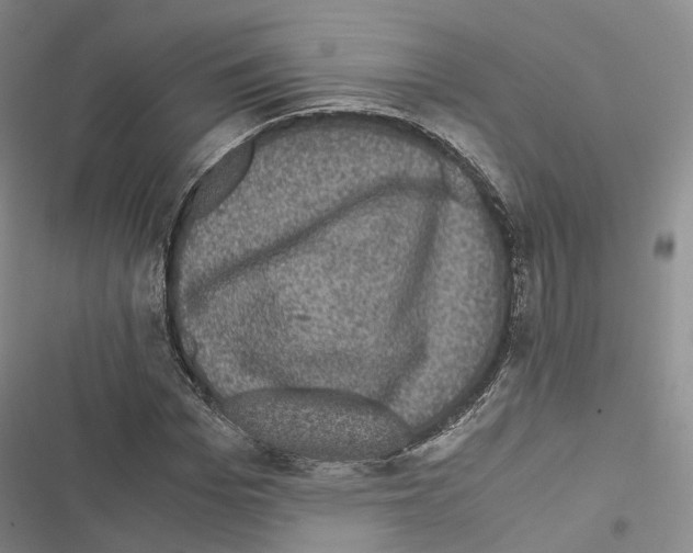 X0000116440969201001191528