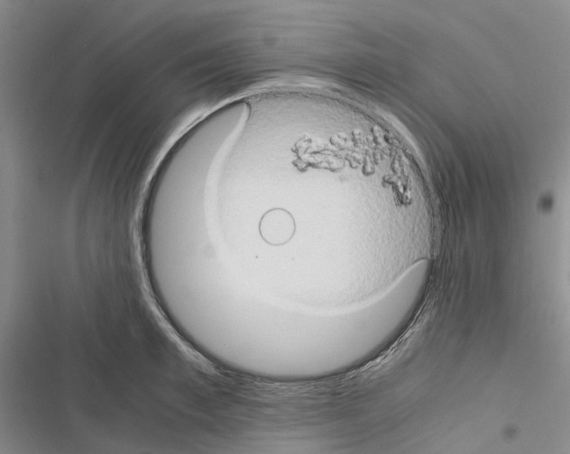 X0000116440997201001191528