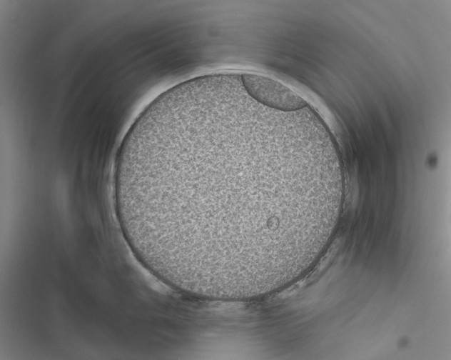 X0000116441006201001191528