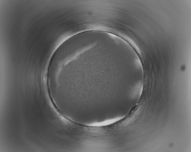 X0000116441007201001191528