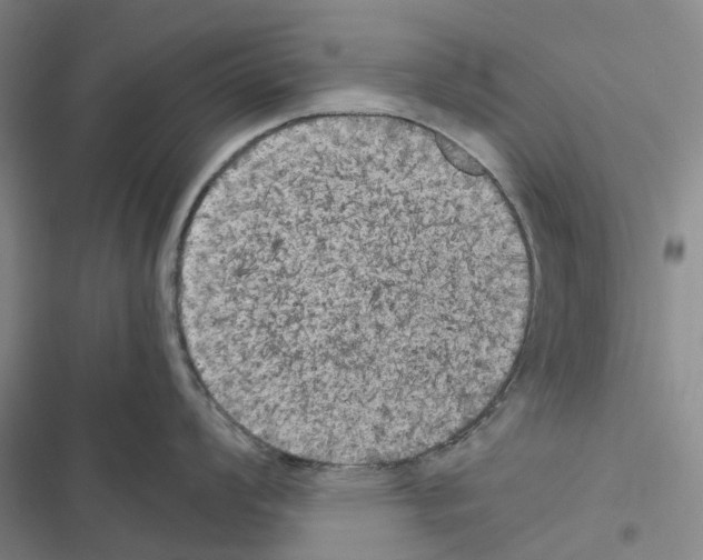 X0000116441008201001191528