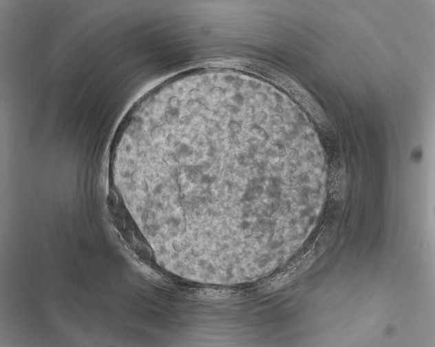 X0000116441036201001191527