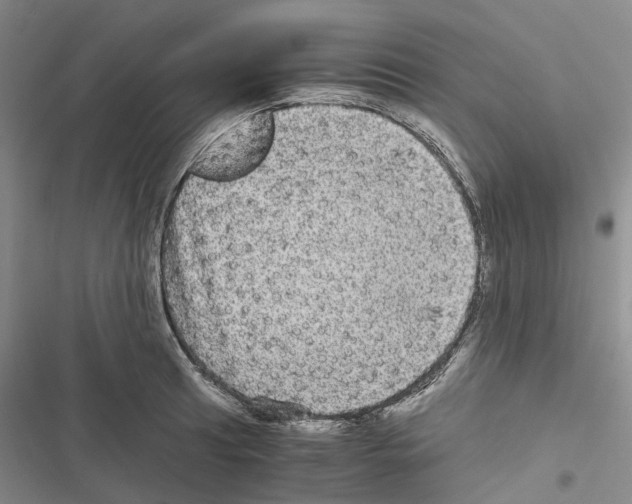 X0000116441041201001191527