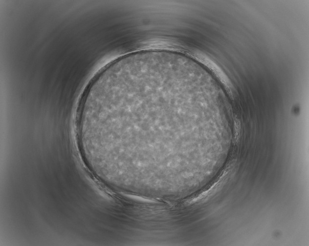 X0000116441043201001191527