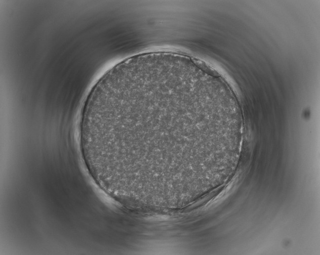 X0000116441054201001191528