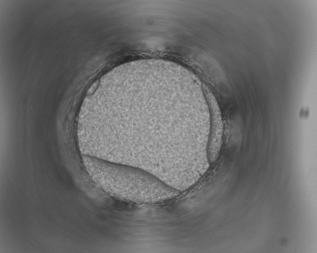 X0000116441057201001191527