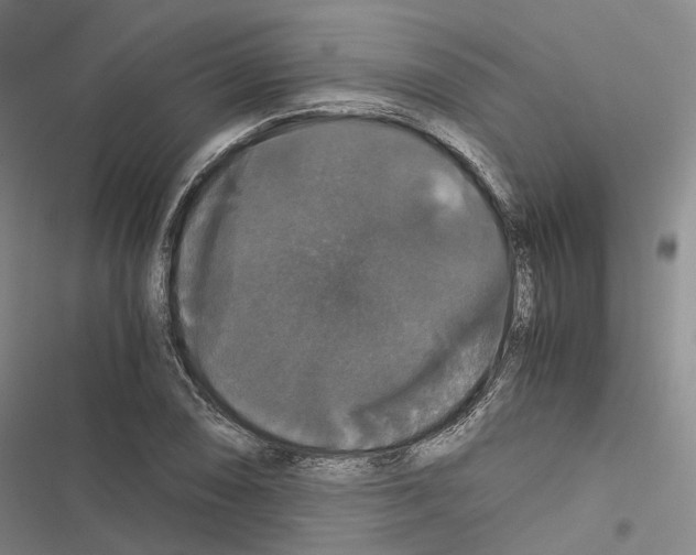 X0000116441074201001191527