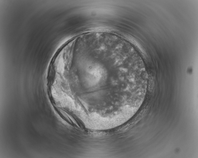 X0000116441087201001191527