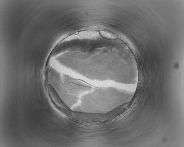 X0000116441095201001191526