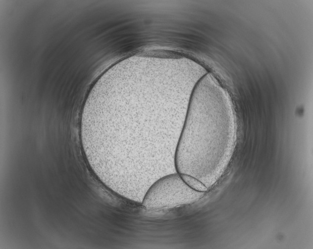 X0000116441137201001191526