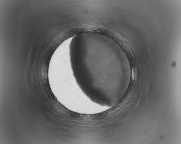 X0000116441155201001191526