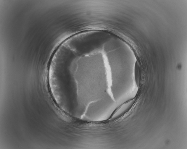 X0000116441179201001191525