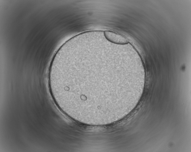 X0000116441187201001191525