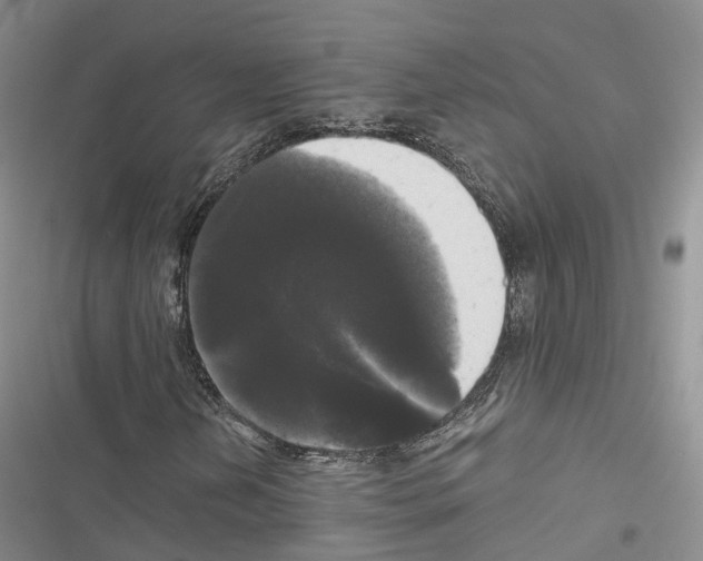 X0000116441202201001191524