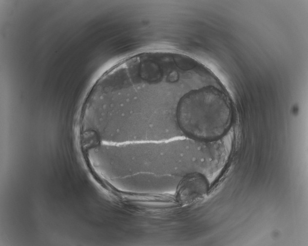 X0000116441245201001191525