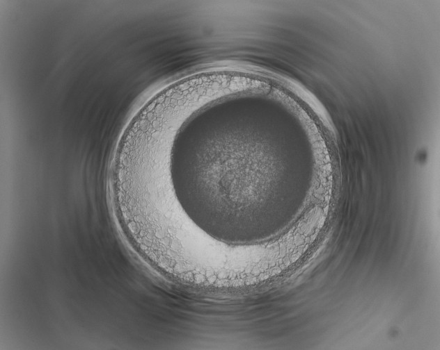 X0000116441338201001191524