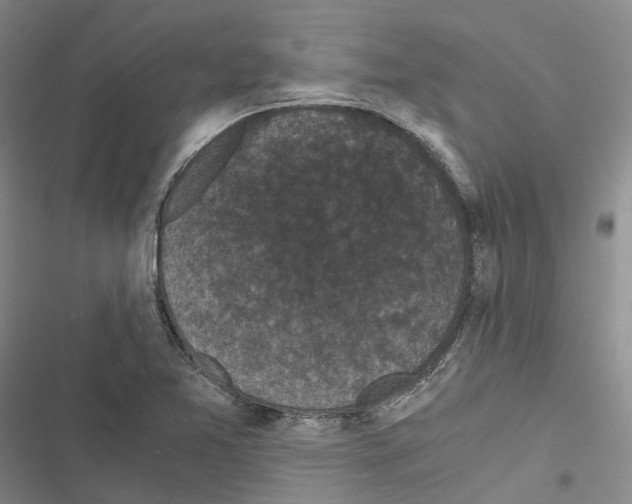 X0000116441365201001191523