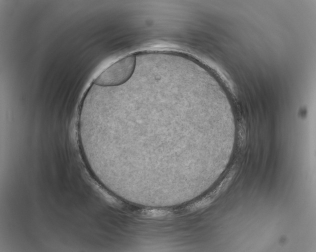 X0000116441374201001191523