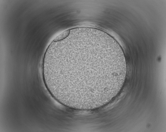 X0000116441387201001191523