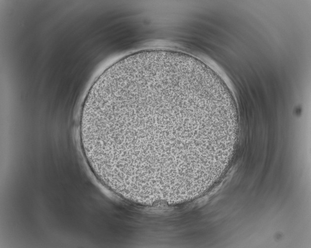 X0000116441437201001191522