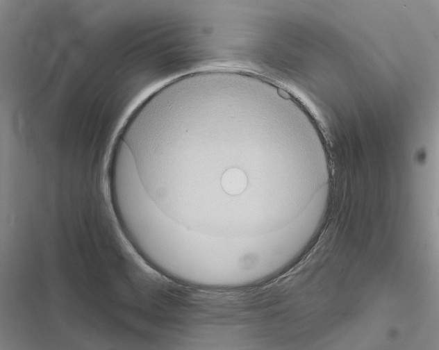 X0000116441468201001191521