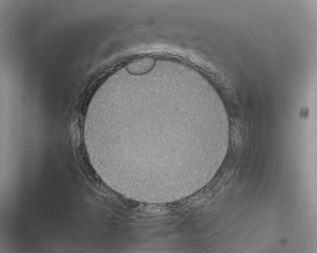 X0000116441493201001191521