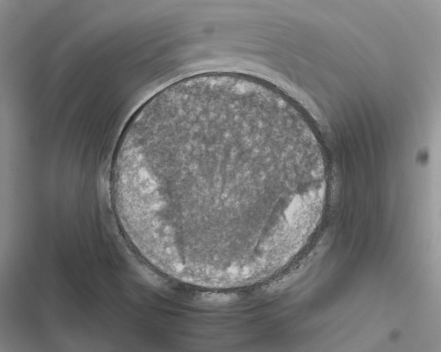 X0000116441513201001191521