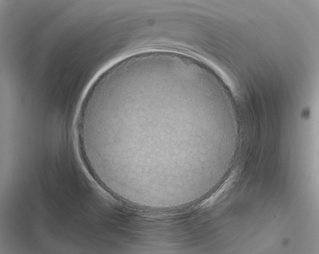 X0000116441514201001191521