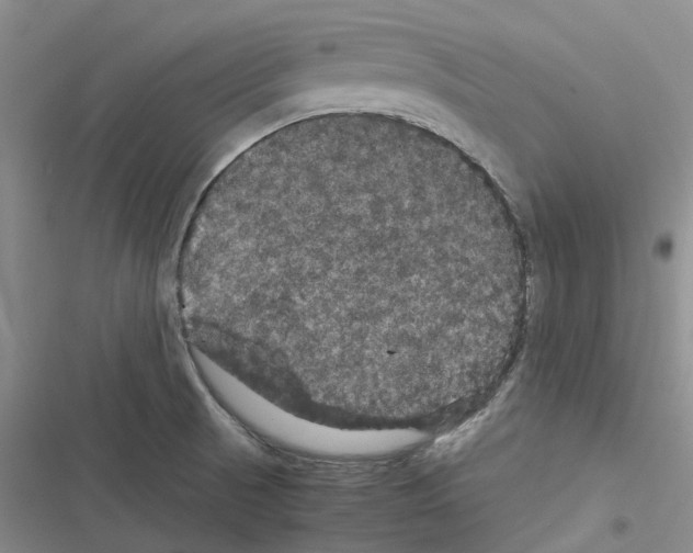 X0000116441521201001191521