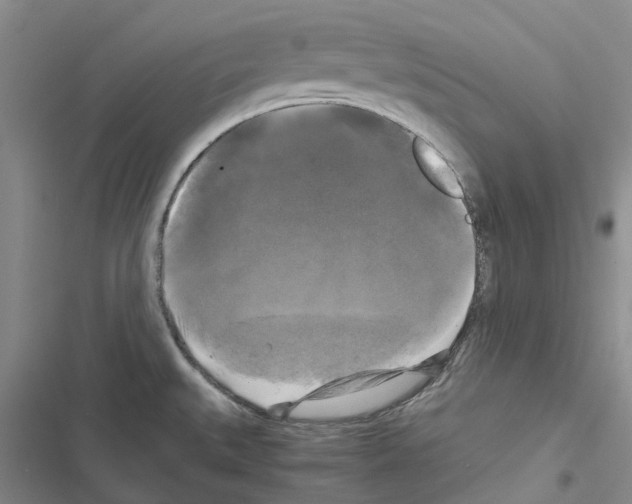 X0000116441527201001191521