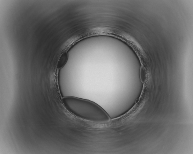 X0000116450785200912081413