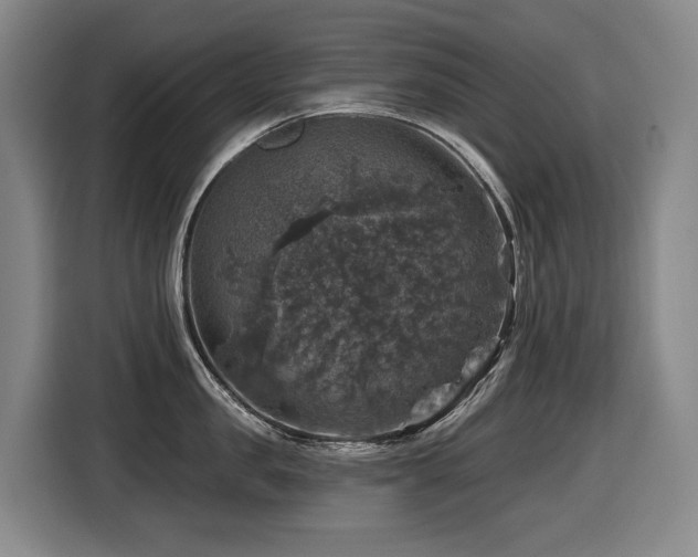 X0000116450957200912081615