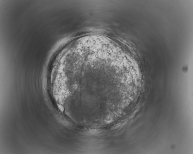X0000116450149201001191600