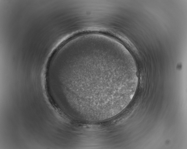 X0000116450436201001191556
